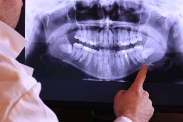 Best Emergency Cosmetic Dentistry in Princeton Meadows, NJ