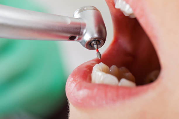 Best Emergency Dentist for Knocked-Out Tooth in Princeton Meadows, NJ
